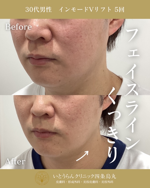 No.9677の症例写真 No.9677の症例写真
