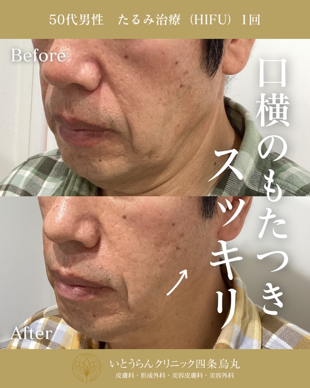No.9661の症例写真