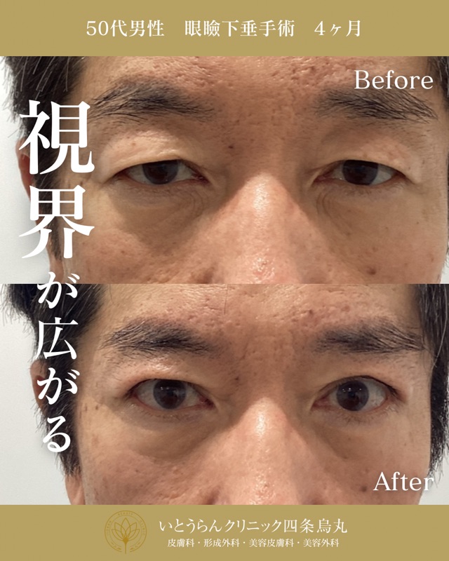 No.9685の症例写真