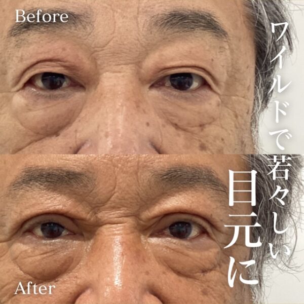 No.9647の症例写真