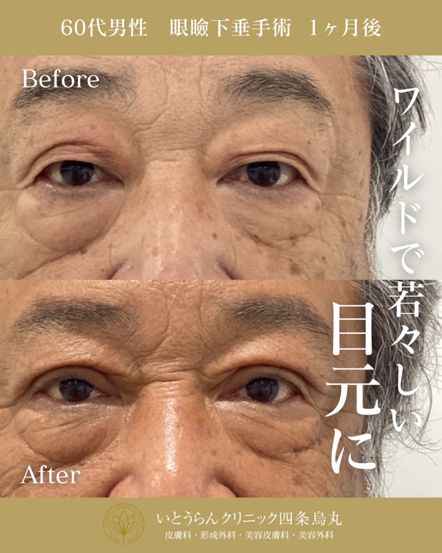 No.9647の症例写真
