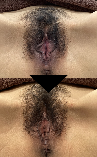 No.10197の症例写真 No.10197の症例写真
