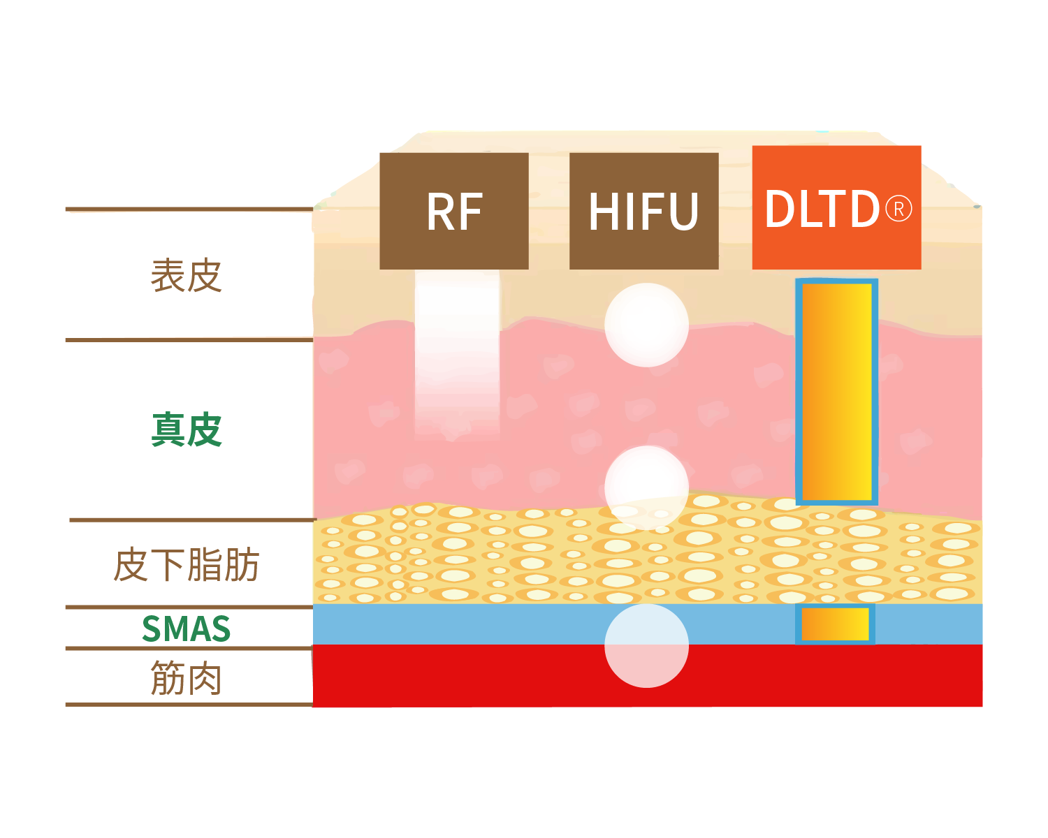 DLTD®加熱プロセスの仕組み図