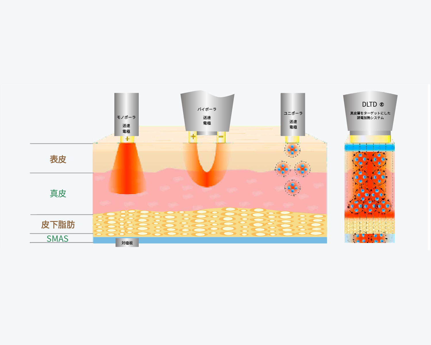 DLTD®加熱プロセスの仕組み図