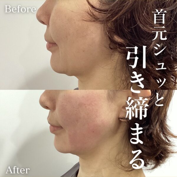 No.10907の症例写真