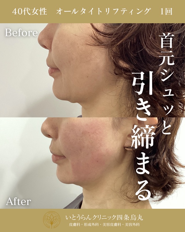 No.10907の症例写真 No.10907の症例写真