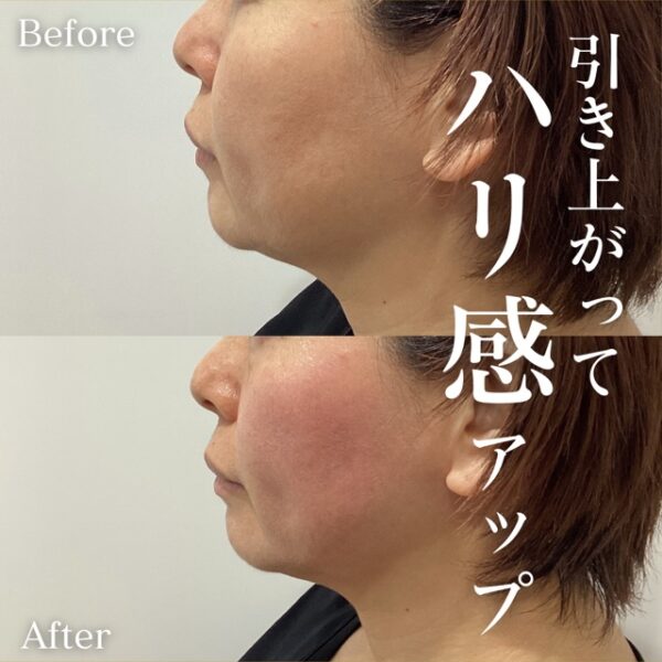 No.10914の症例写真