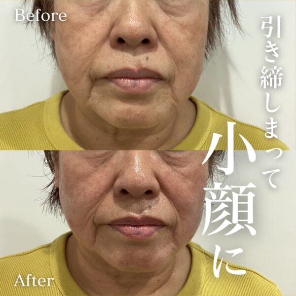 No.10932の症例写真