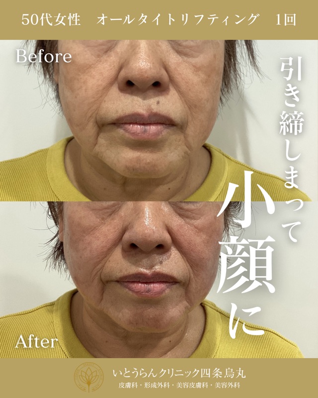 No.10932の症例写真