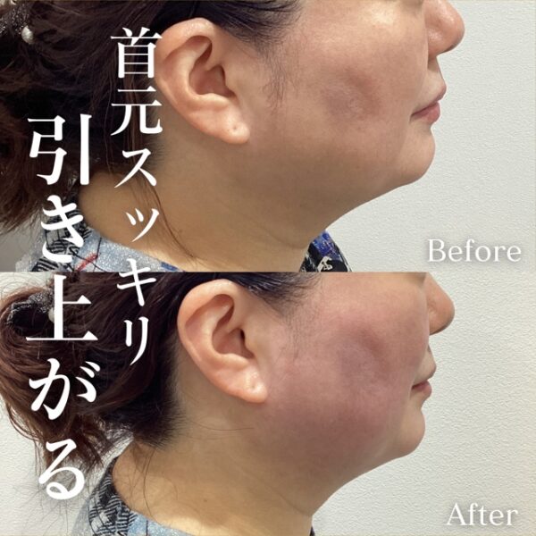 No.10922の症例写真