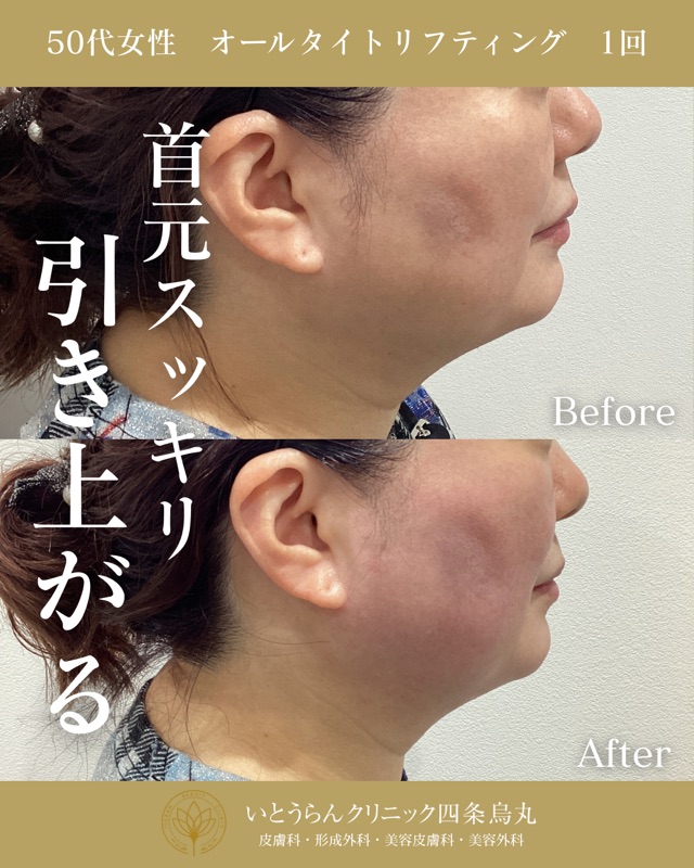 No.10922の症例写真