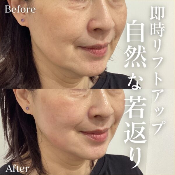 No.10927の症例写真