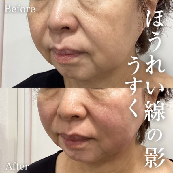 No.10937の症例写真
