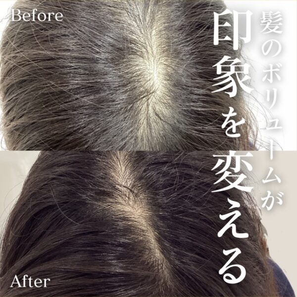 No.16934の症例写真 No.16934の症例写真