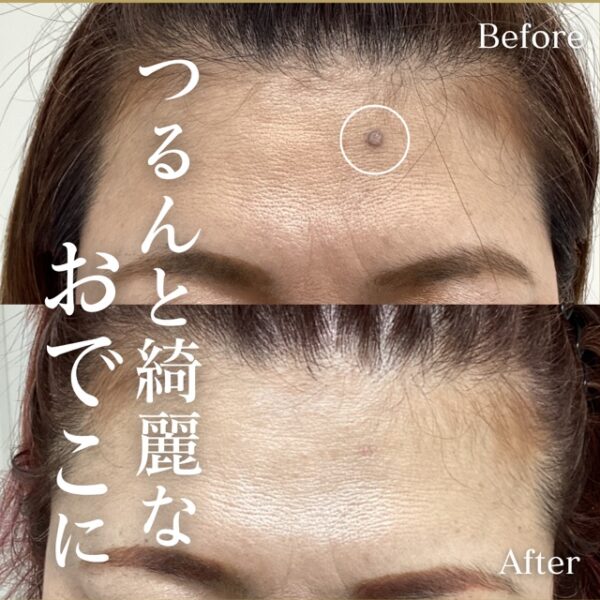 No.16921の症例写真