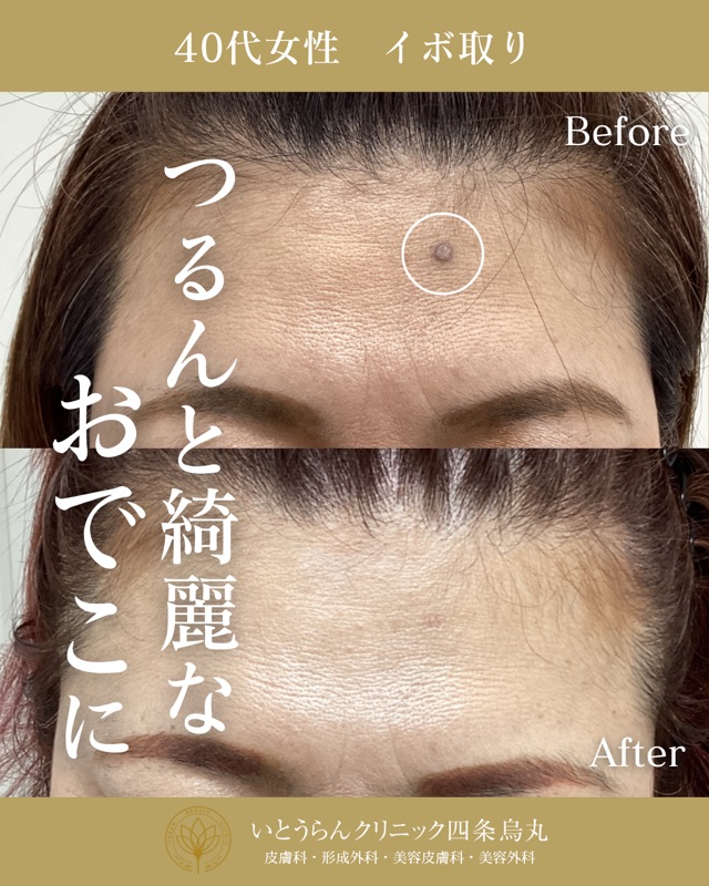 No.16921の症例写真