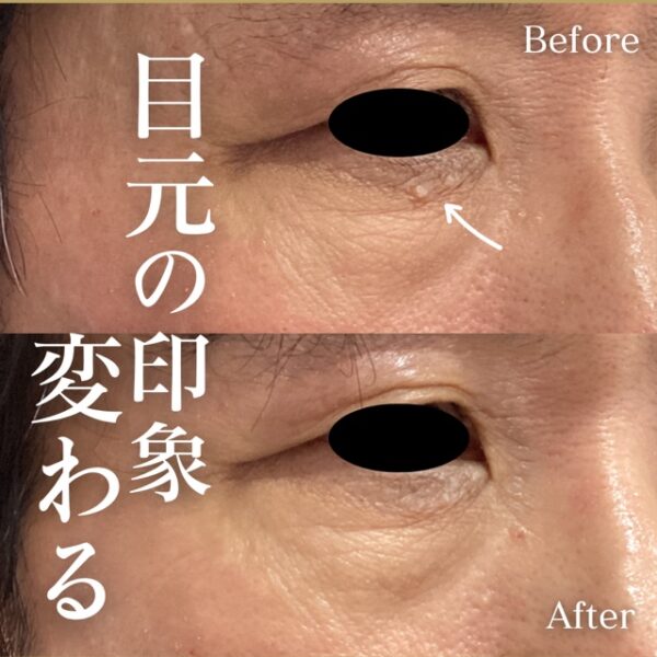 No.16919の症例写真 No.16919の症例写真