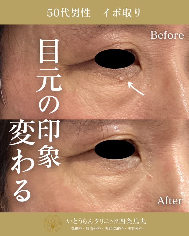 No.16919の症例写真 No.16919の症例写真