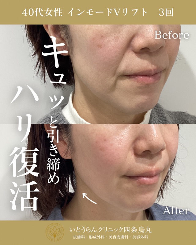 No.16552の症例写真 No.16552の症例写真