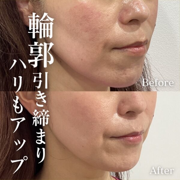 No.17024の症例写真