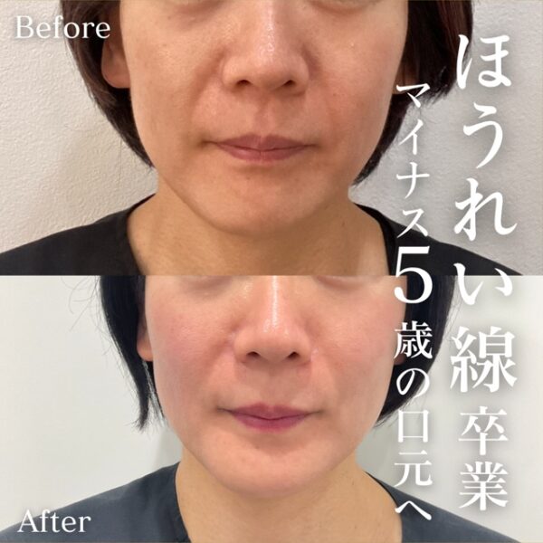 No.16567の症例写真
