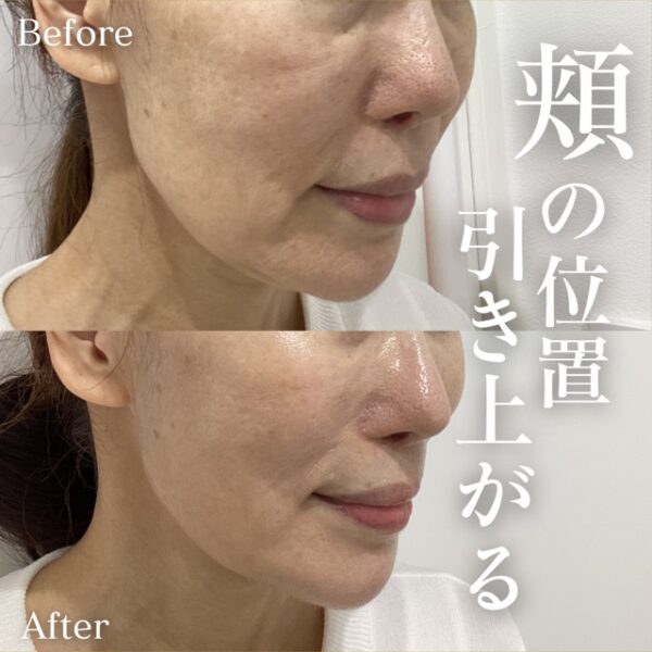 No.16946の症例写真 No.16946の症例写真