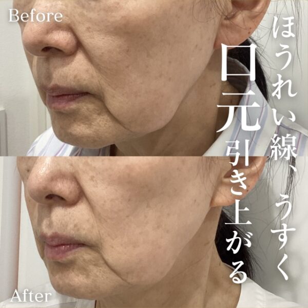 No.17034の症例写真