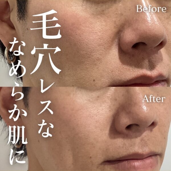 No.16914の症例写真