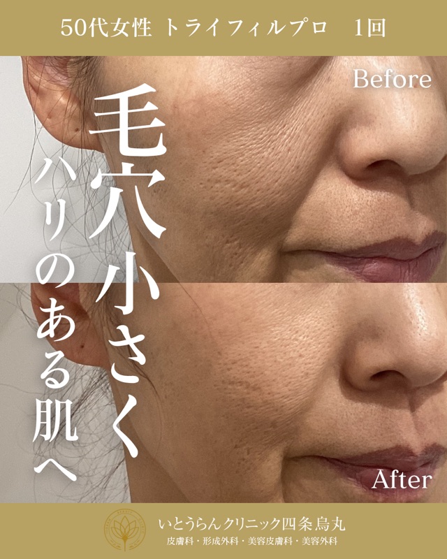 No.16909の症例写真 No.16909の症例写真