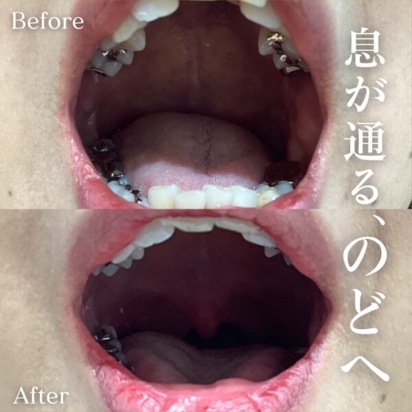 No.16826の症例写真