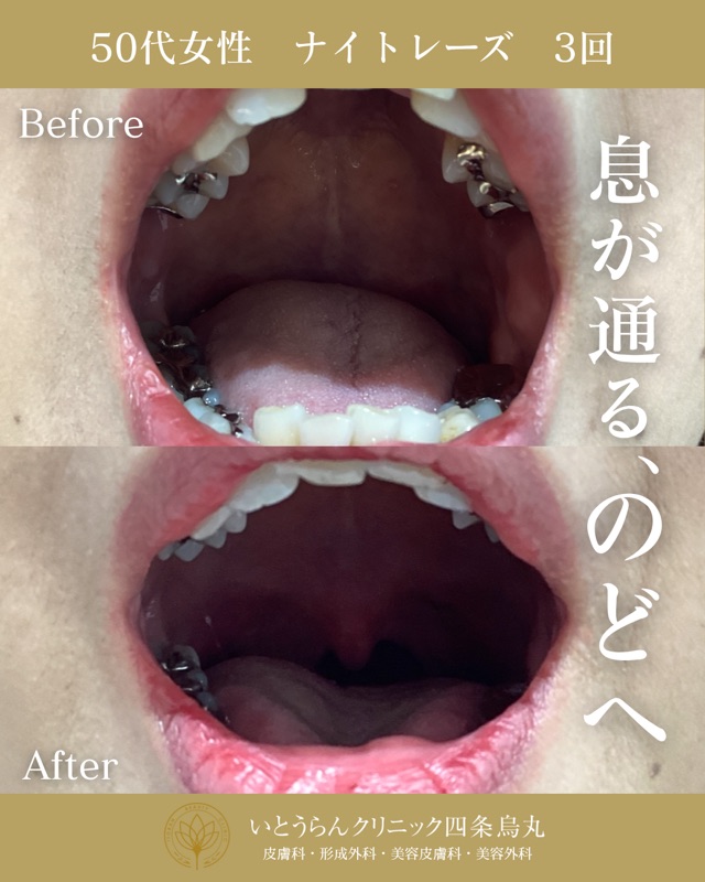 No.16826の症例写真