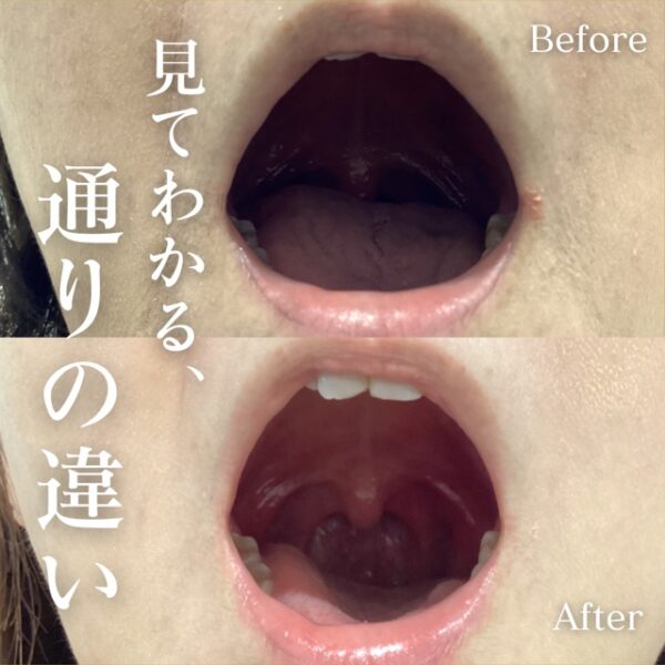 No.16831の症例写真