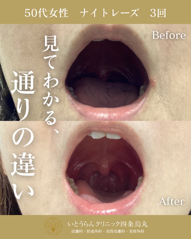 No.16831の症例写真