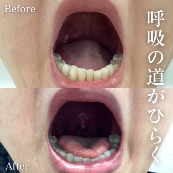 No.16836の症例写真