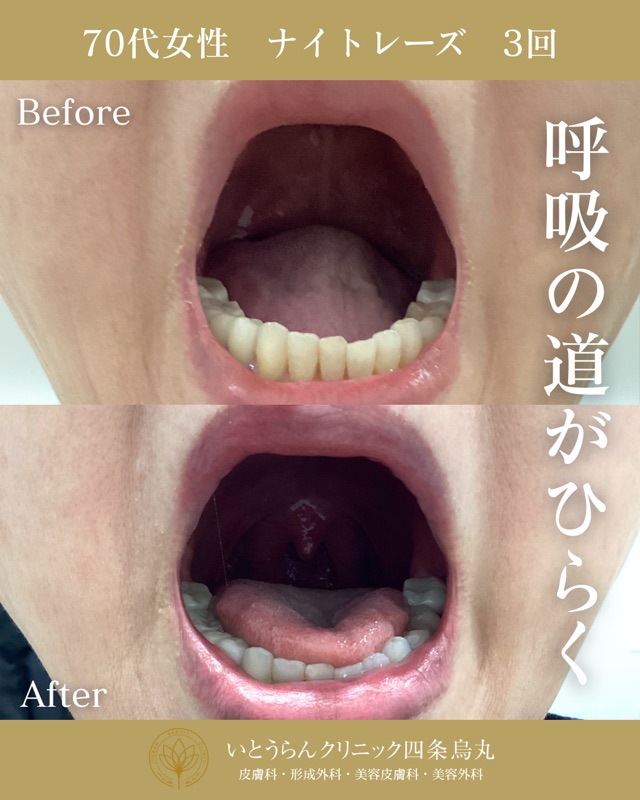 No.16836の症例写真