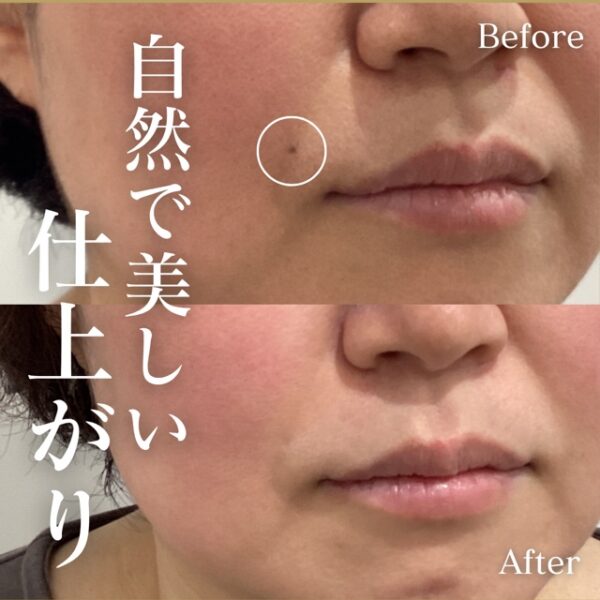 No.16929の症例写真 No.16929の症例写真