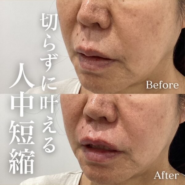 No.17029の症例写真