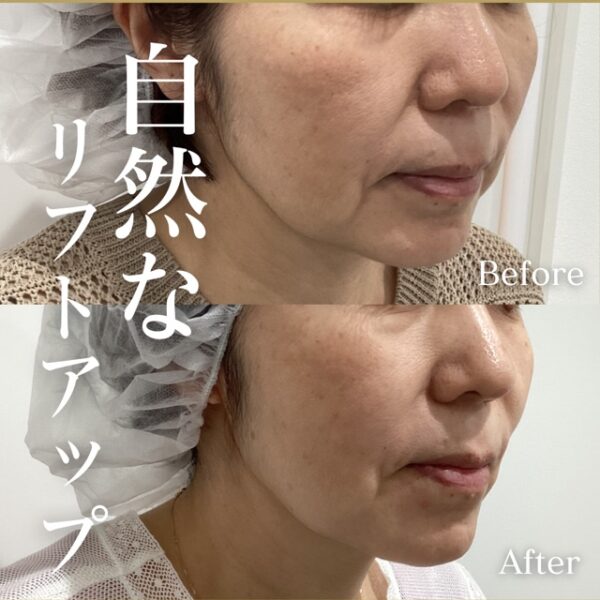 No.16885の症例写真