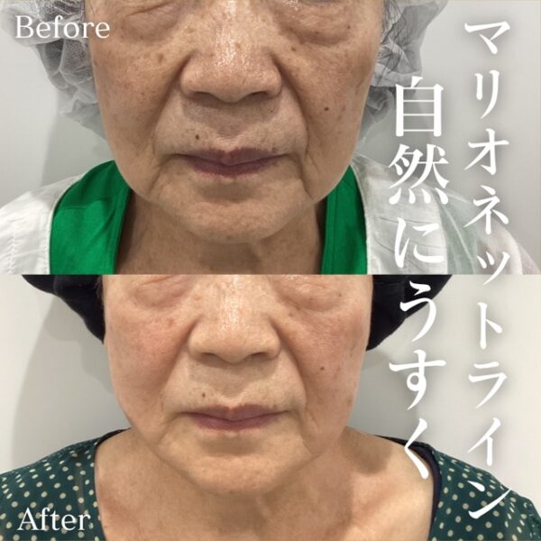 No.16892の症例写真
