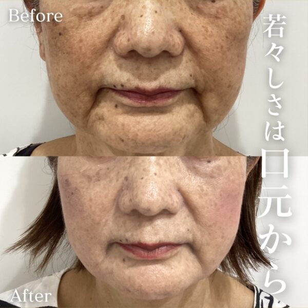 No.16897の症例写真