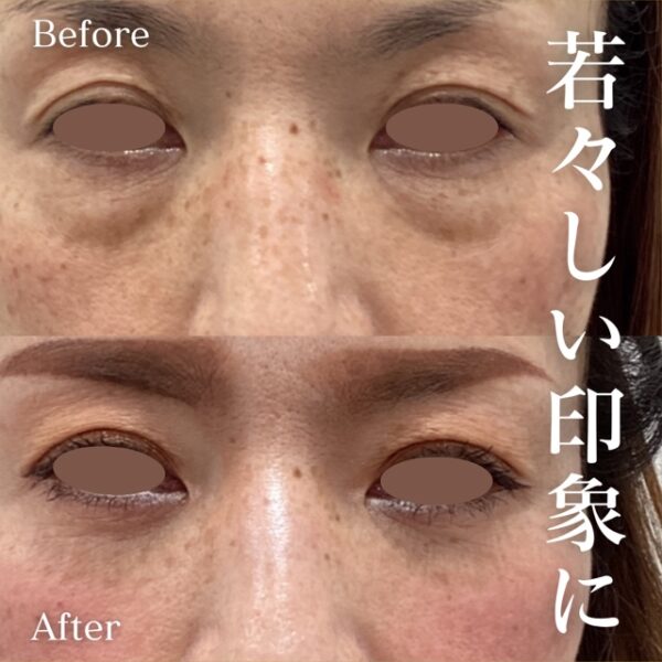 No.17070の症例写真