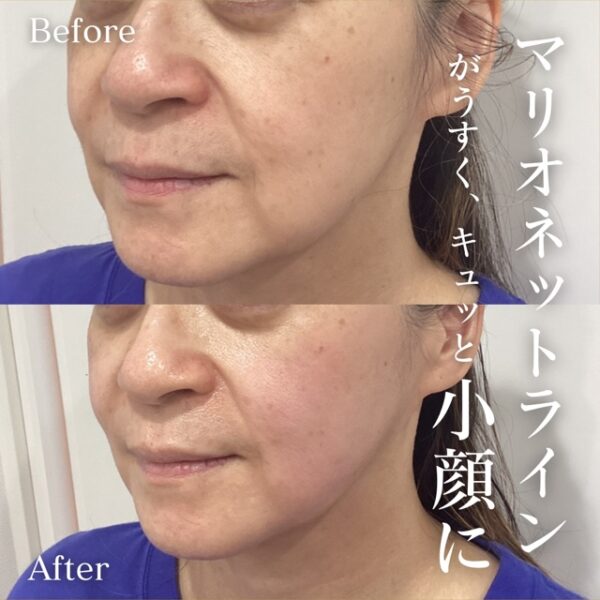 No.17382の症例写真