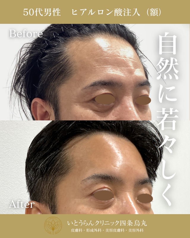 No.17531の症例写真 No.17531の症例写真