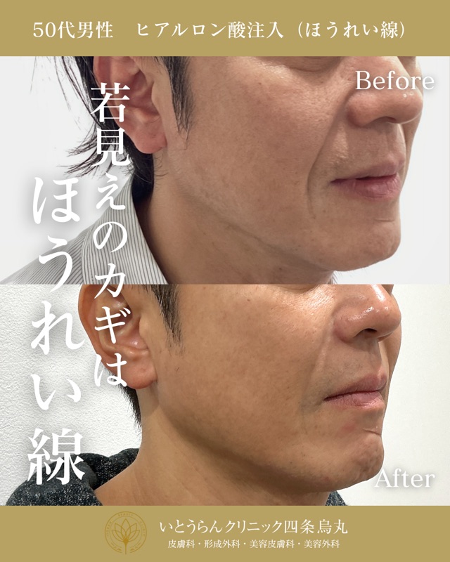 No.17536の症例写真