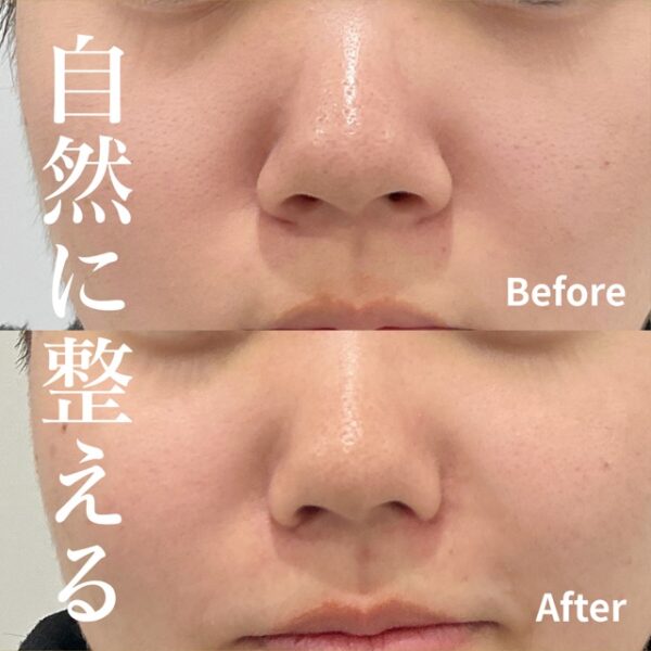 No.17760の症例写真