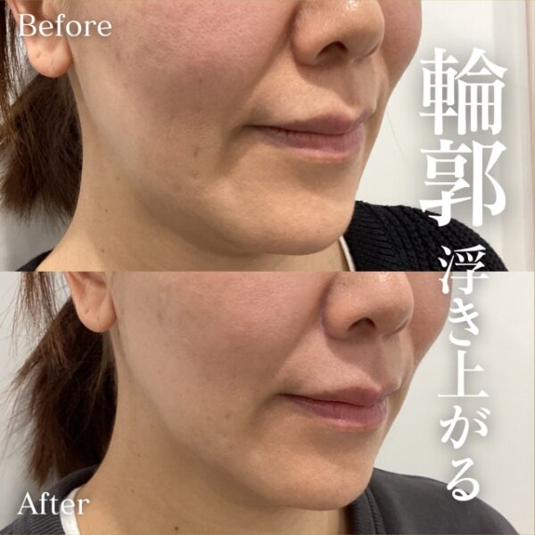 No.18005の症例写真