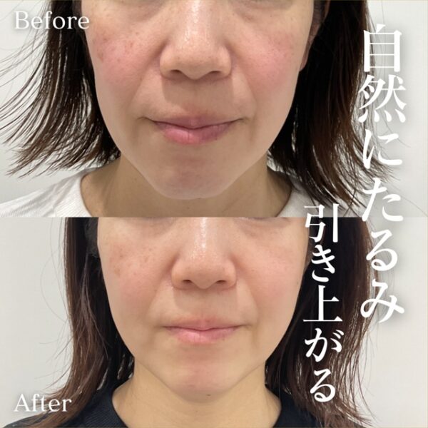 No.17995の症例写真