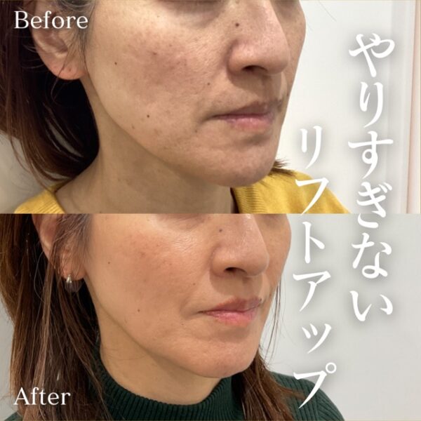 No.17985の症例写真