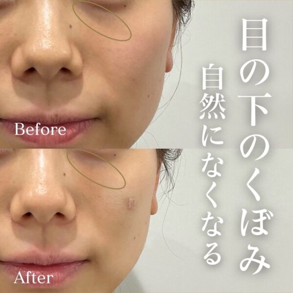 No.18857の症例写真