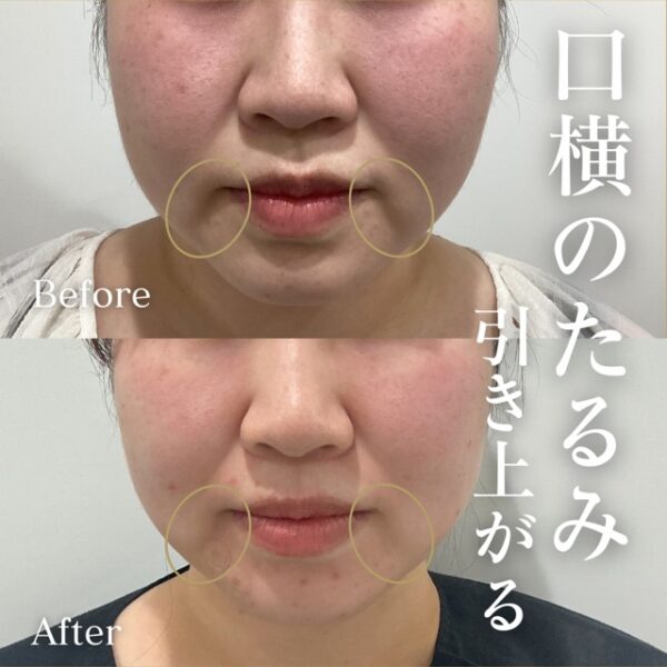 No.18862の症例写真